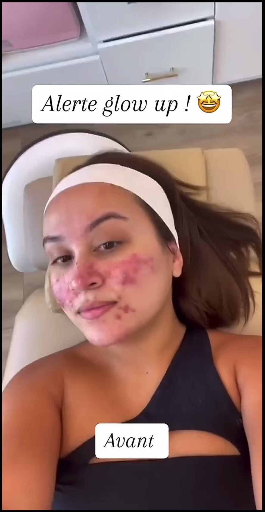 Masque de Visage LED Thérapeutique